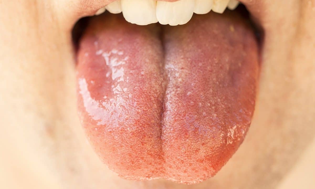 Jakie są najważniejsze zasady higieny jamy ustnej