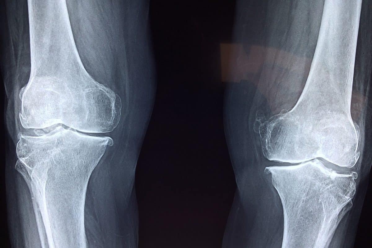 USG ortopedyczne – lepiej z nim nie zwlekaj!
